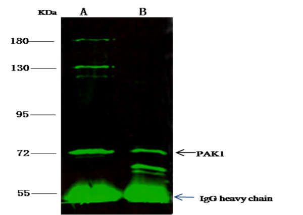 Anti-PAK1 Polyclonal Antibody