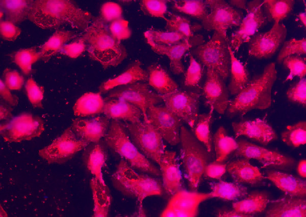 Anti-SPARCL1/SPARC-like 1 Monoclonal Recombinant Antibody