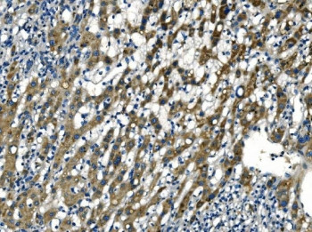 Anti-Apelin / APLN / APEL