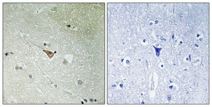 Anti-Phospho-ALK (Tyr1096)