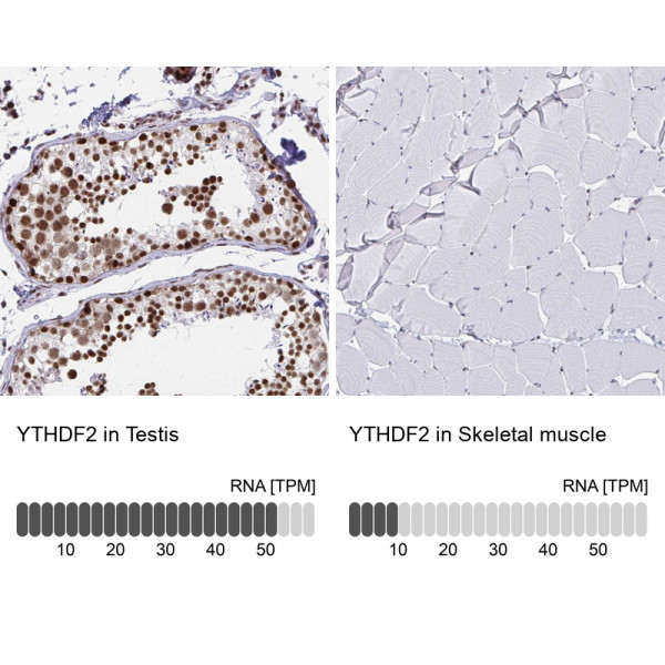 Anti-YTHDF2