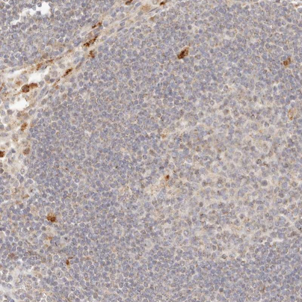Anti-PTPN22