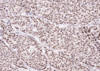 Anti-CUEDC2 Monoclonal Recombinant Antibody
