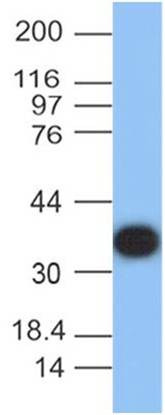 Anti-Protein A Monoclonal Antibody (Clone: ABM4B3.1G3)