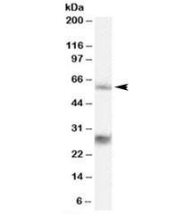 Anti-MPP6