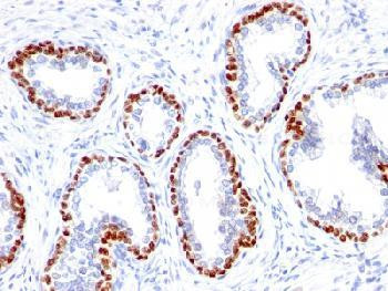 Anti-p63 (Squamous, Basal &amp; Myoepithelial Cell Marker) Recombinant Rabbit Monoclonal Antibody (clone