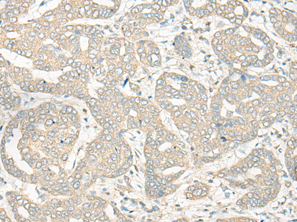 Anti-HLA-DRB5