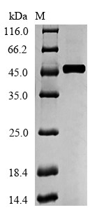 Medium-chain specific acyl-CoA dehydrogenase, mitochondrial (ACADM), human, recombinant