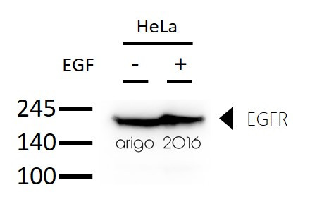 Anti-EGFR, clone 3F12-1H7-A10