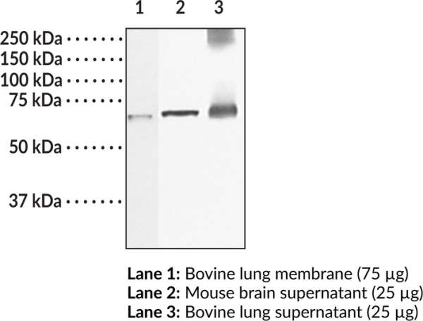 Anti-Guanylate Cyclase beta1 subunit (soluble)