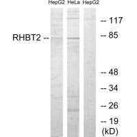 Anti-RHOBTB2