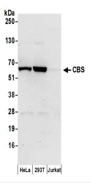 Anti-CBS