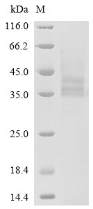 Poly [ADP-ribose] polymerase 14 (PARP14), partial, human, recombinant