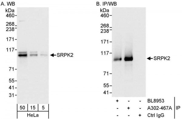 Anti-SRPK2