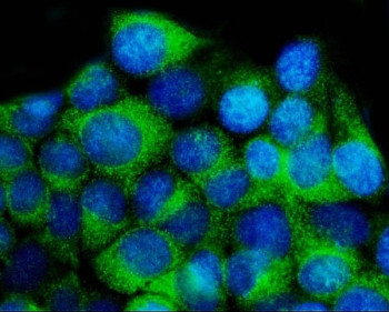 Anti-14-3-3 epsilon / YWHAE