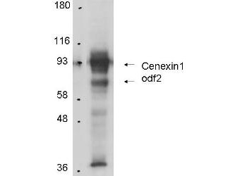 Anti-Cenexin-1