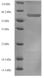Plasminogen activator inhibitor 1 (Serpine1), mouse, recombinant