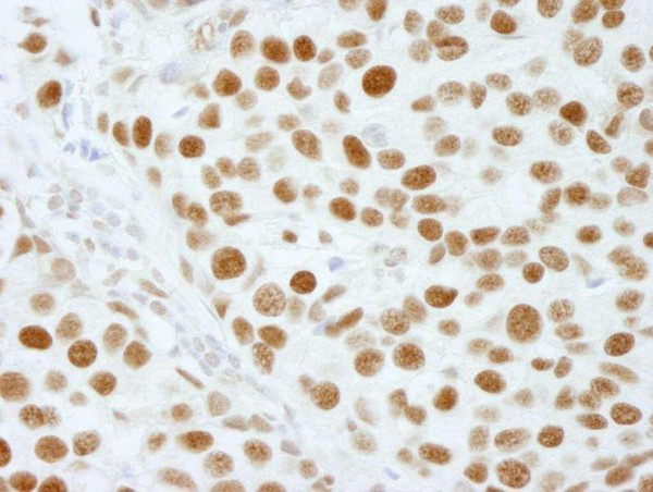 Anti-XRN2 (IHC)