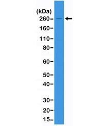 Anti-ACC / Acetyl CoA Carboxylase, clone RM232 (recombinant antibody)