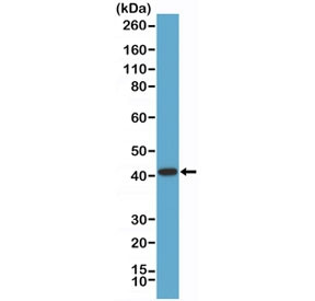 Anti-AMACR / Alpha-methylacyl-CoA racemase (recombinant antibody), clone RM349