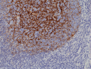 Anti-CD21 (human), Rabbit Monoclonal (RM372)