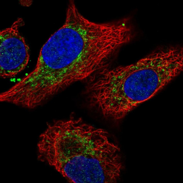 Anti-IDH3B