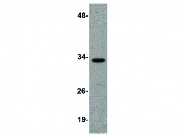 Anti-RNAse H2A