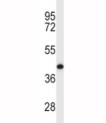 Anti-MCL1