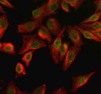 Anti-SPO11 / Meiotic recombination protein SPO11
