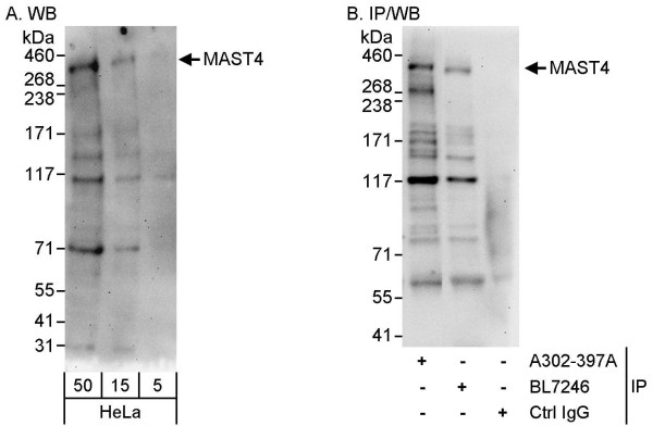 Anti-MAST4