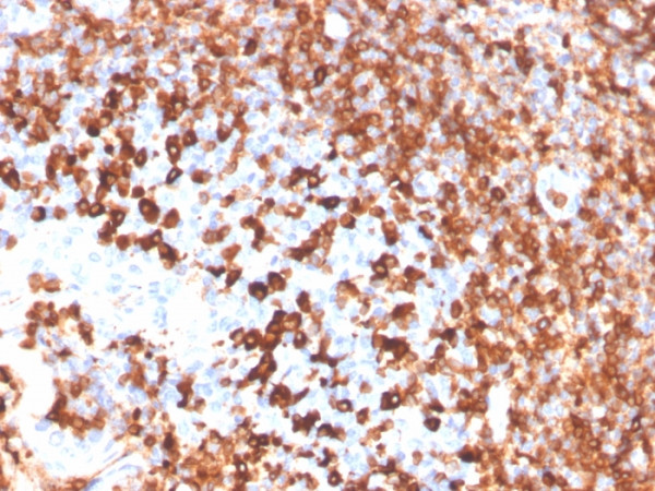Anti-CD79a (B-Cell Marker), recombinant antibody, clone IGA/3939R