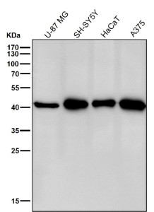 Anti-CABP1 / Calcium binding protein 1, clone 31C60