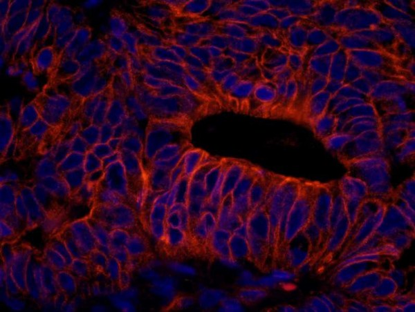 Anti-SPTAN1/Alpha II-spectrin IHC Antibody, affinity purifie (IHC)