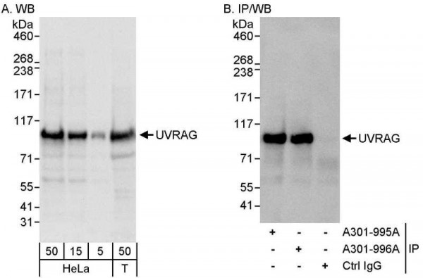 Anti-UVRAG