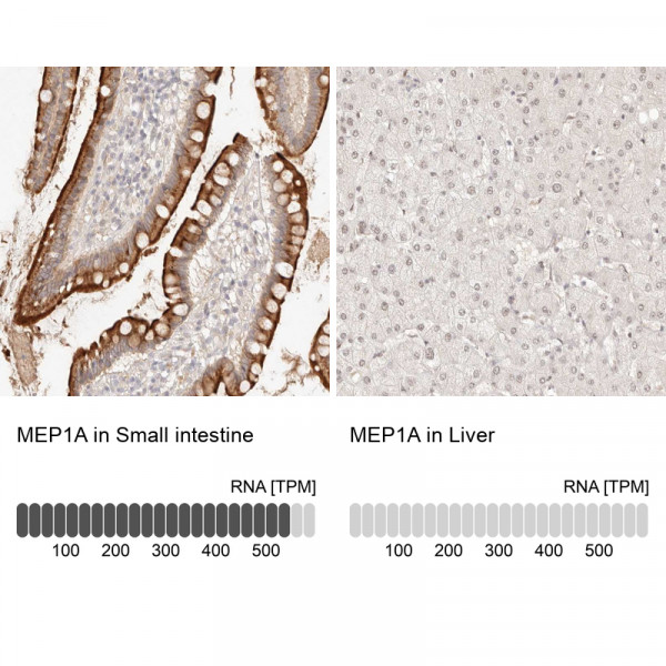 Anti-MEP1A