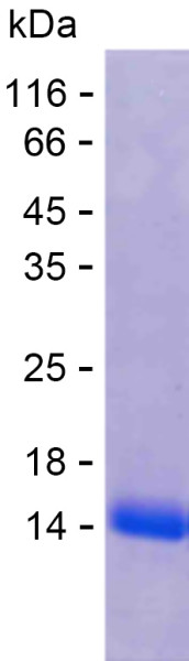 Recombinant Human ITPR2 Protein