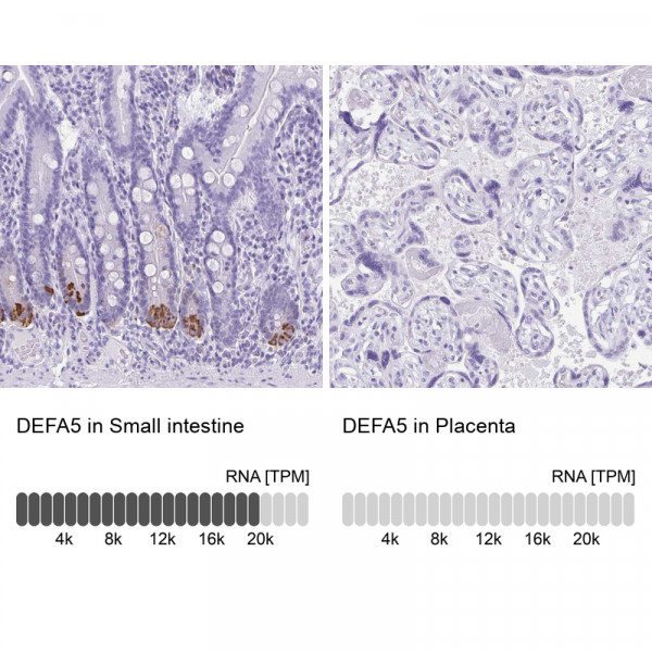Anti-DEFA5