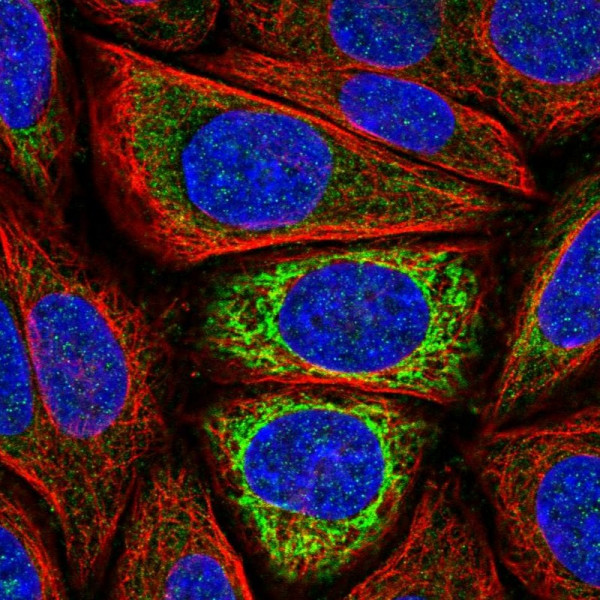 Anti-IDH3A