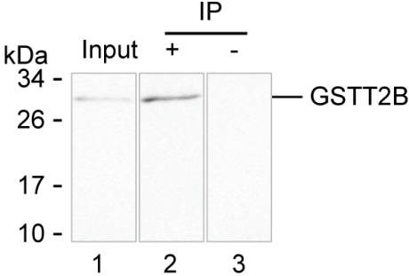Anti-GSTT2B