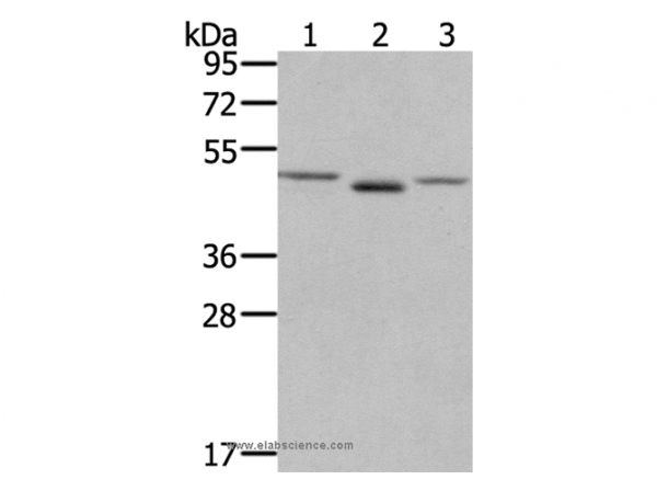 Anti-FGFRL1
