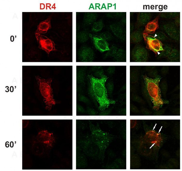 Anti-ARAP1 / centaurin Monoclonal Antibody (Clone:ARAP1-2)