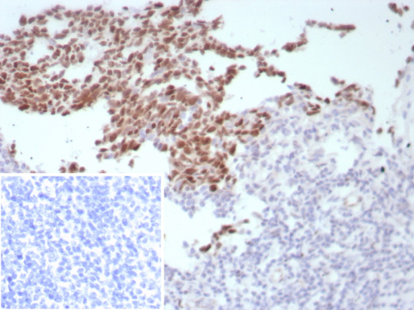 Anti-Bcl-6 (Follicular Lymphoma Marker), recombinant antibody, clone BCL6/8808R