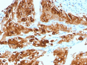 Anti-Uroplakin 1A / UPK1A, clone UPK1A/2921