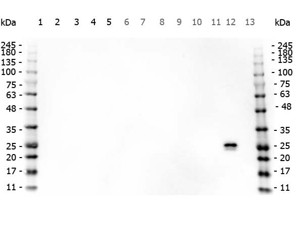 Anti-Glutathione-S-Transferase (GST) (Schistosoma japonicum)