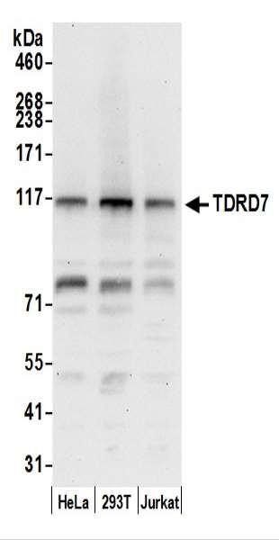 Anti-TDRD7
