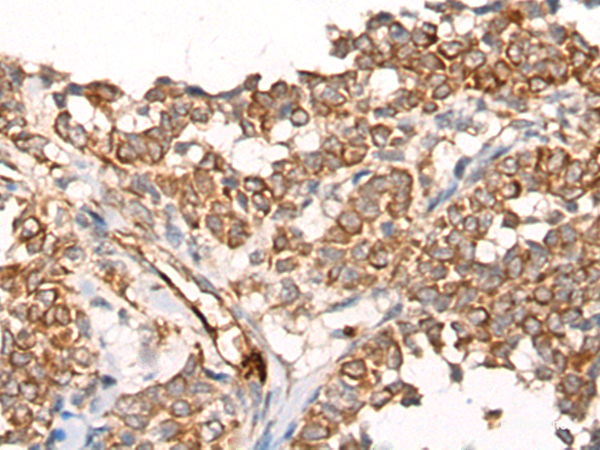 Anti-CA5B