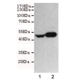Anti-NSE / Neuron Specific Enolase, clone 1G7-B4