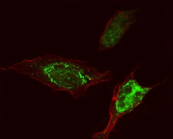 Anti-PLEKHA5 Antibody / PEPP-2