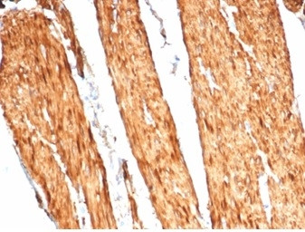 Anti-Caldesmon, HMW (h-Caldesmon) (Smooth Muscle Marker), recombinant antibody, clone CALD1/7024R