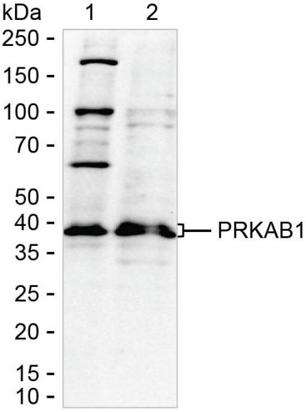 Anti-AMPK beta 1
